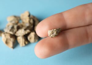 ממה נוצר אבנים בכליות